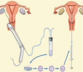 35岁女性备孕请做好以下检查，“健康济南代生宝宝”跑不远